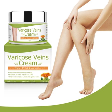 Varicose Veins Cream كريم الدوالي